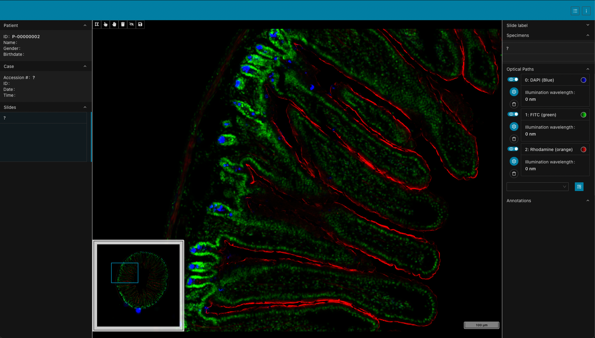 NEMA_3DHISTECH_DAPI-FITC-Rhodamine.png