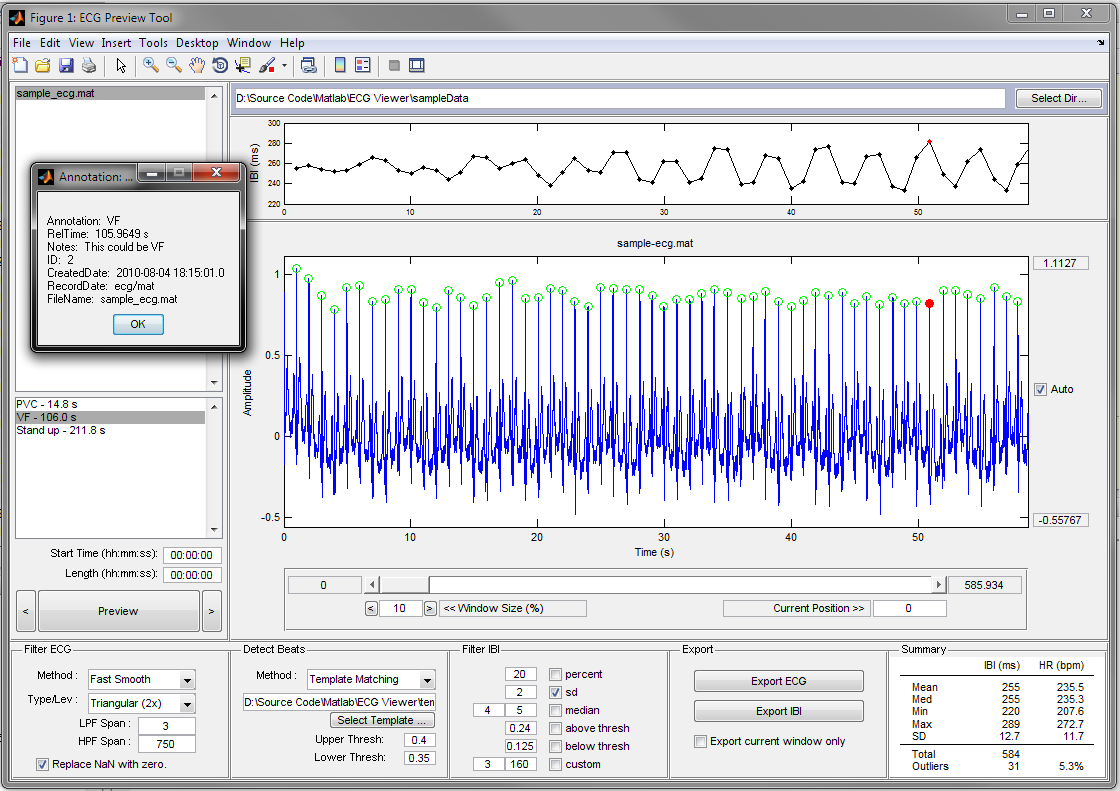 ECG_Viewer.png