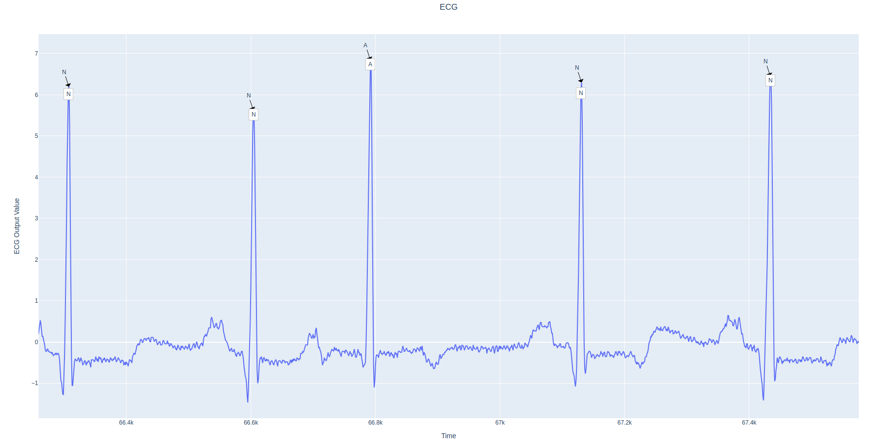 pipeline-viz.png