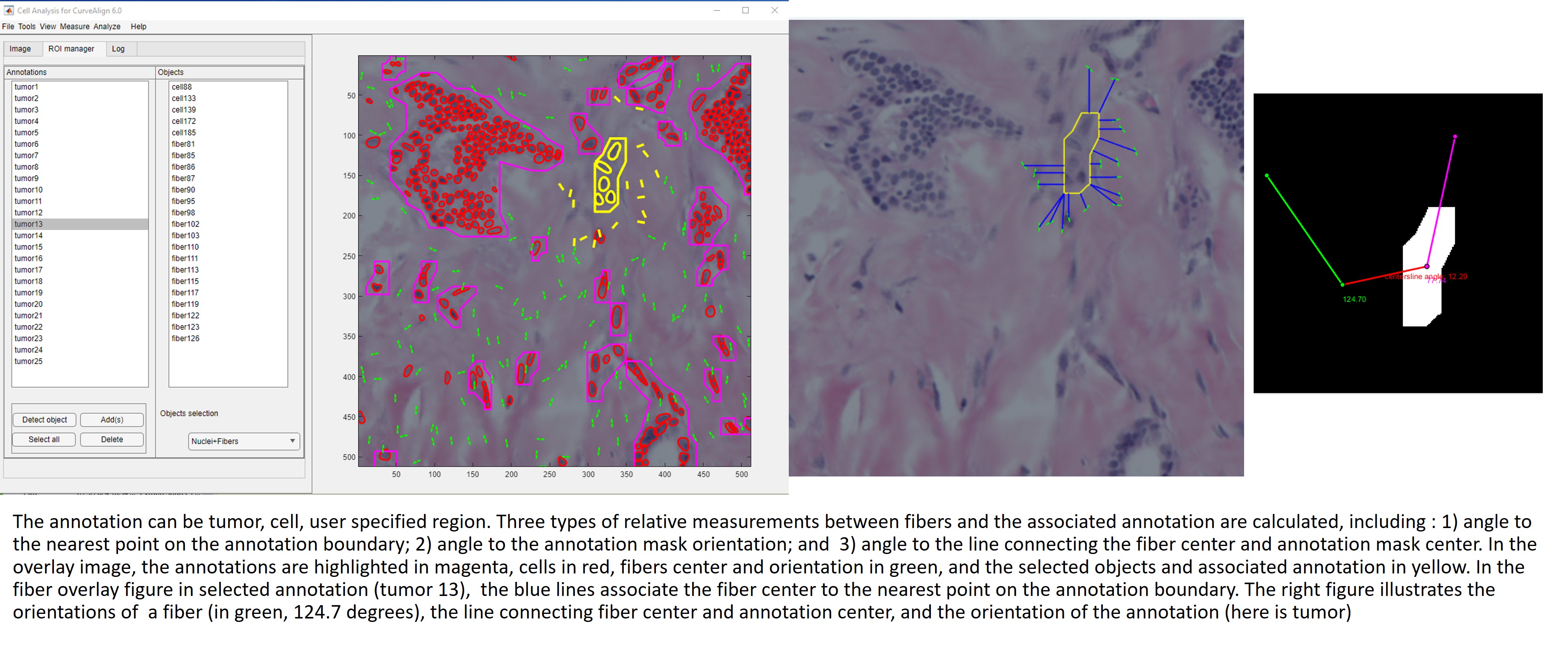 illustration of three relative measurments between fiber and annotation(tumor, cell and user specified ROI) .jpg